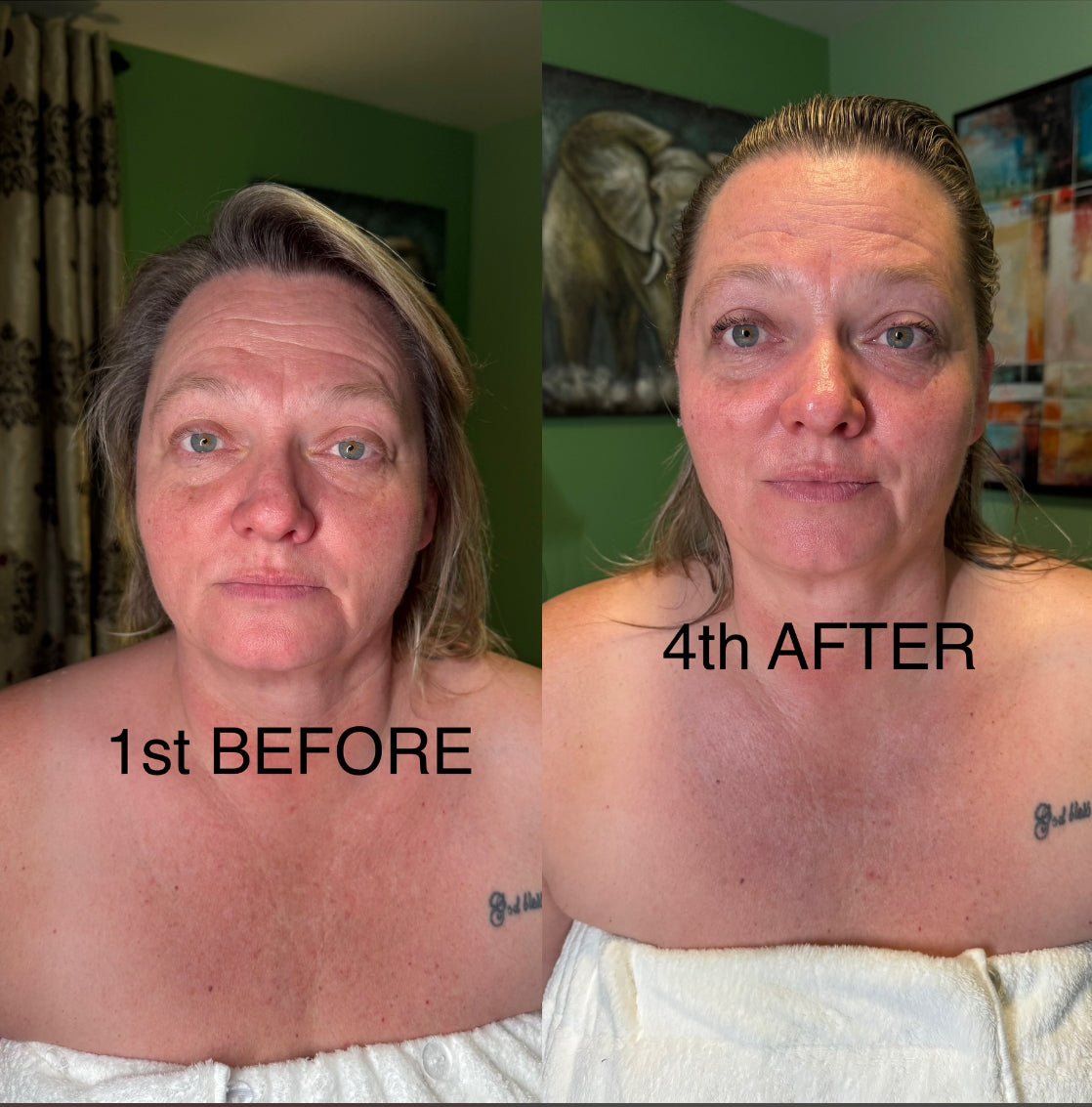 Extensive Buccal Facelift With Lymphatic Drainage & Myofacial Release Treatment (Includes LED Light Therapy) 100 Minutes